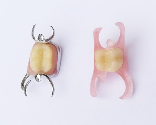 ถอนฟันกรามต้องใส่ฟันปลอมไหม