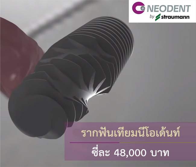 รากฟันเทียม neodent ราคา
