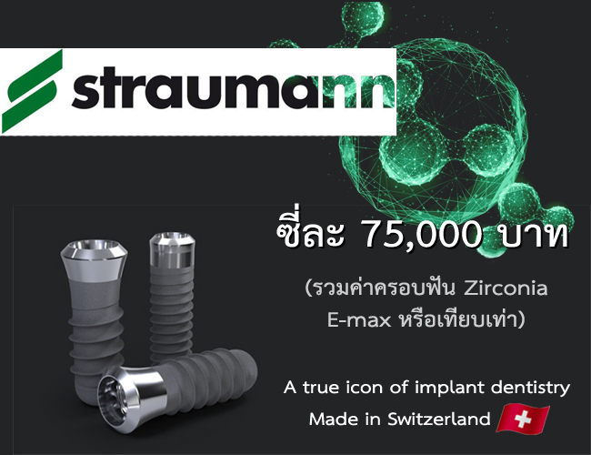 รากฟันเทียม straumann ราคา